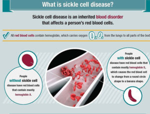 HEALTH MATTERS: Bone Davis brings global awareness to sickle cell disease
