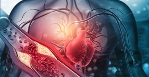 Mental Illness Linked to Higher Heart Disease Risk and Shorter Lives
